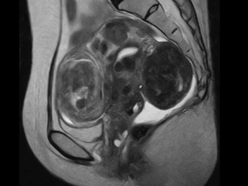 レディースMRI画像